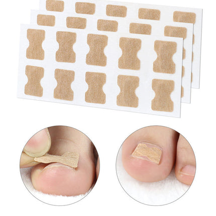 Glue-free orthopaedic nail fixation device